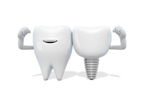 种植牙多少钱一颗种植牙有纳入医保吗.jpg